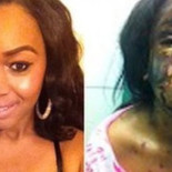 "Me desfiguró con ácido porque la llamé monstruo"