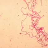 "Science" dedica su portada a una investigación española sobre la enfermedad de pian