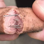 Se extiende la práctica de colocar comida con alfileres en diferentes ciudades para dañar a los perros